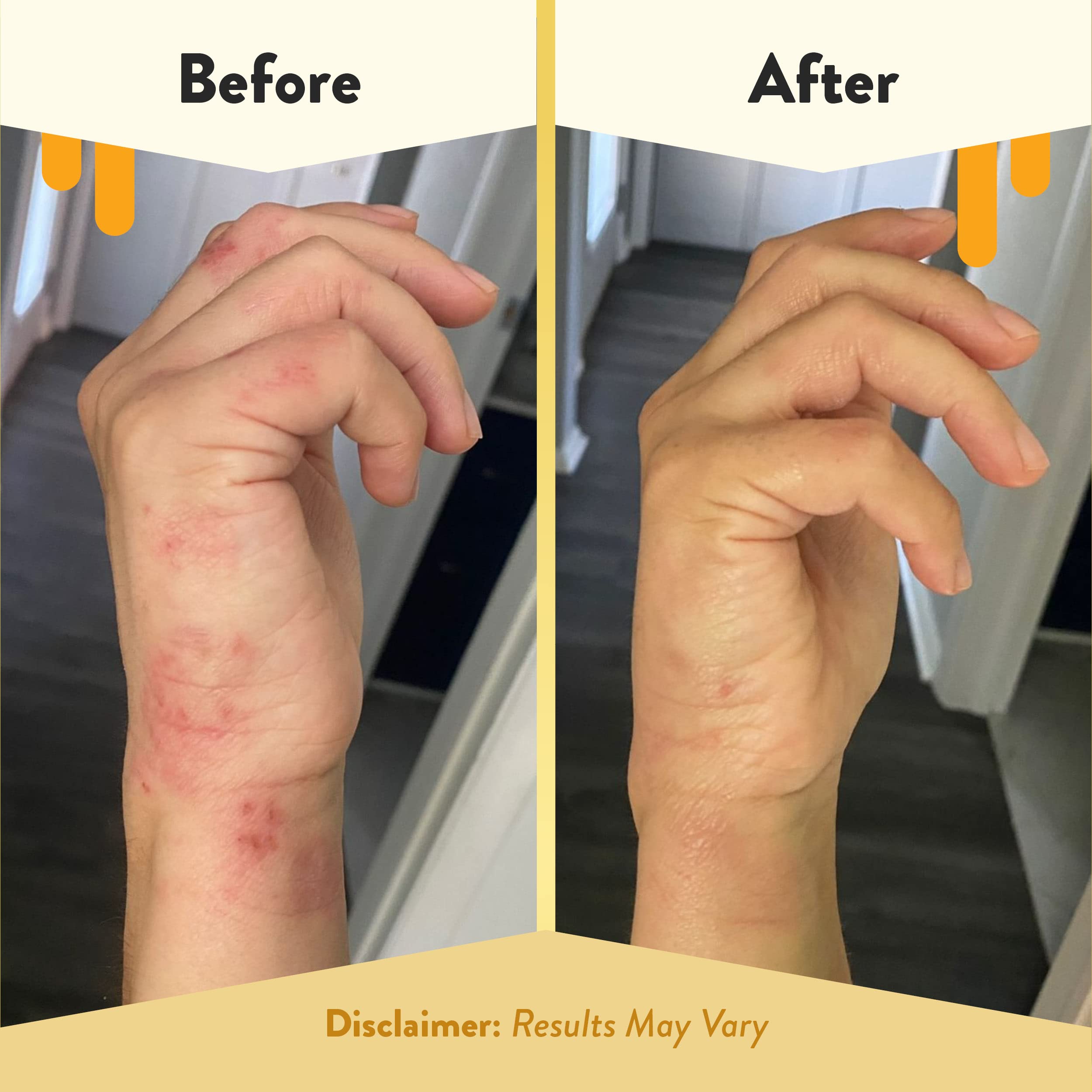 ECZEMA HONEY Antioxidant Body Oil – Unscented After-Shower Moisturizer for Eczema-Prone Skin (8 fl oz)