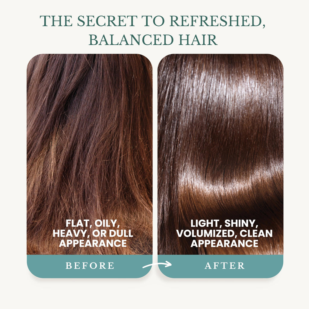 EDENIKA BOTANICALS Peppermint Shampoo with Castor Oil & Biotin – Soothes Scalp, Strengthens Hair, Sulfate-Free 16 oz