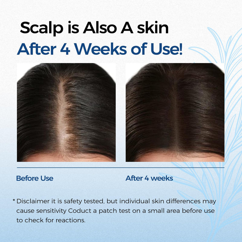 EELEAN Hair Growth Serum Roll-On 25ml – 3% Rosemary, 3% Redensyl & 2% Anagain for Hair Density