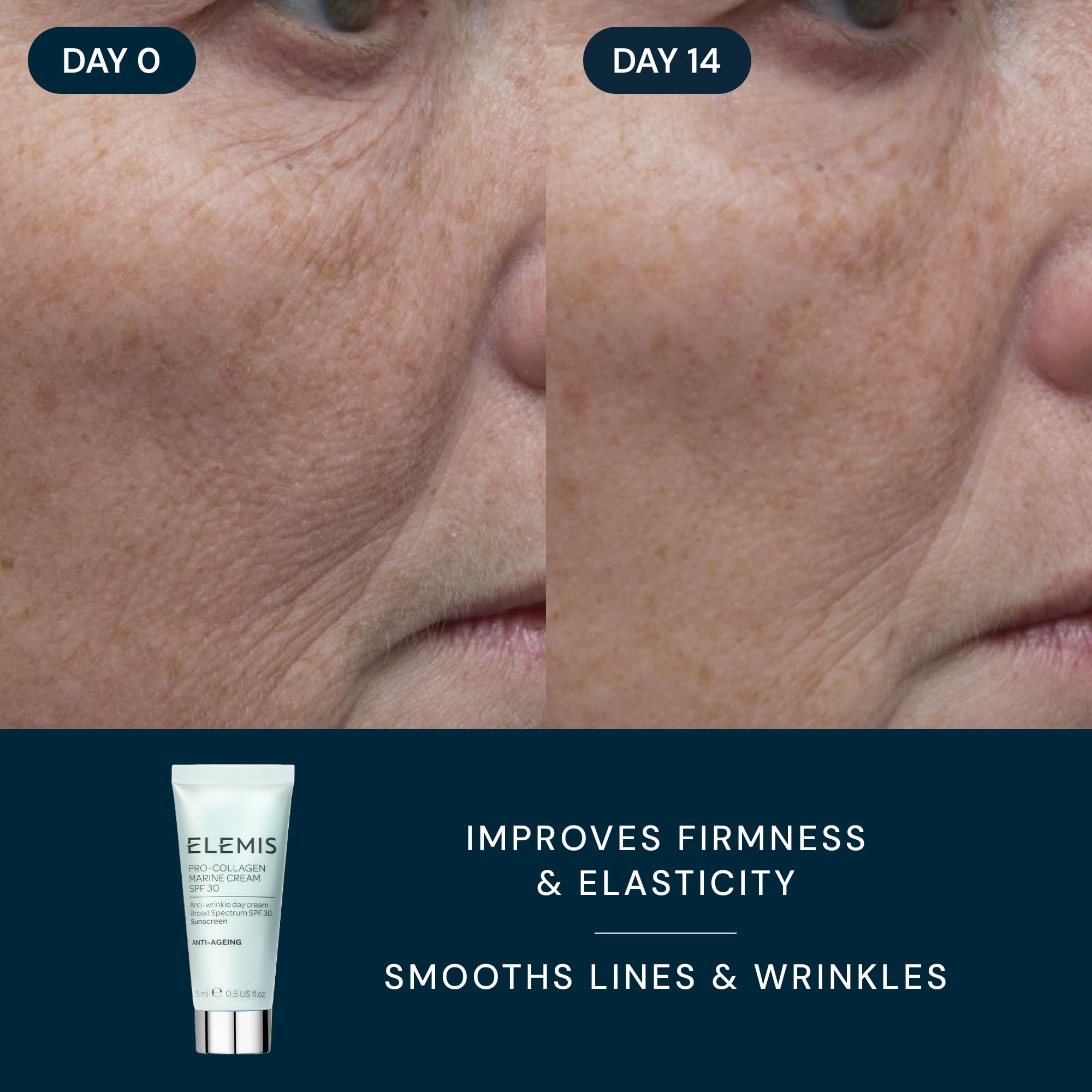 ELEMIS Healthy Skin Travel Set | Pro-Collagen Cleansing Balm Mini, Marine Cream SPF 30 Mini & Dynamic Resurfacing Pads