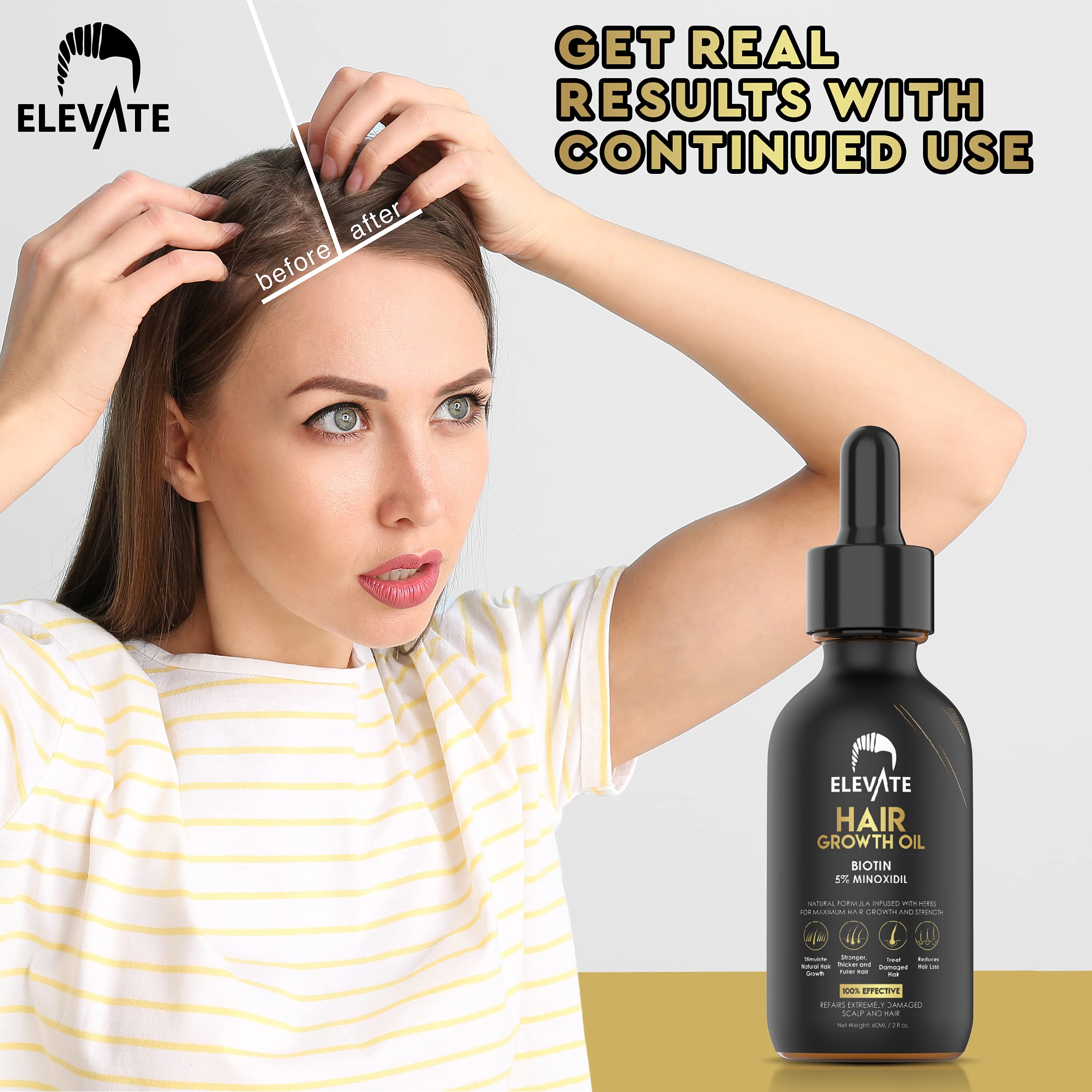 Elevate Hair Regrowth Treatment 5% Minoxidil with Biotin — Fuller, Thicker Hair (2oz)