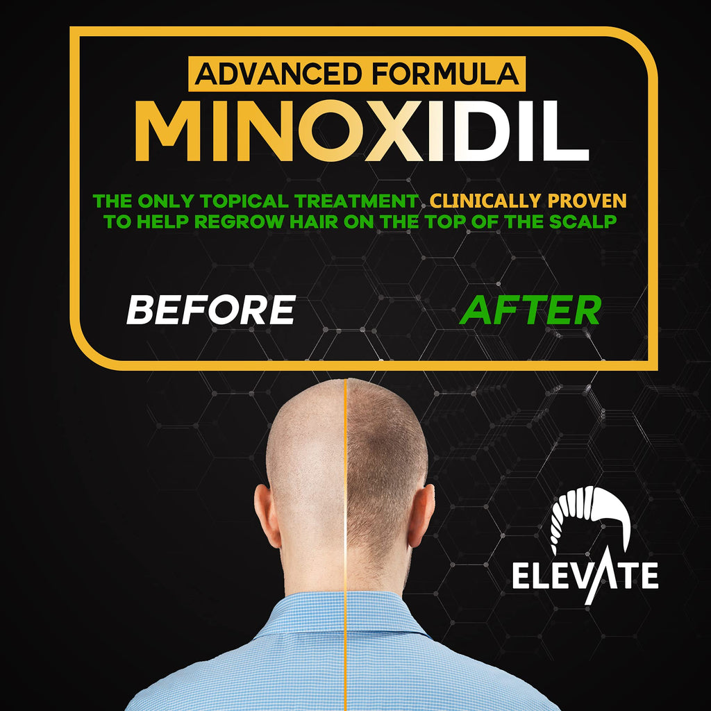 Elevate 5% Minoxidil Spray – Alcohol-Free, Extra Strength Hair Growth for Men & Women | 1 Month Supply