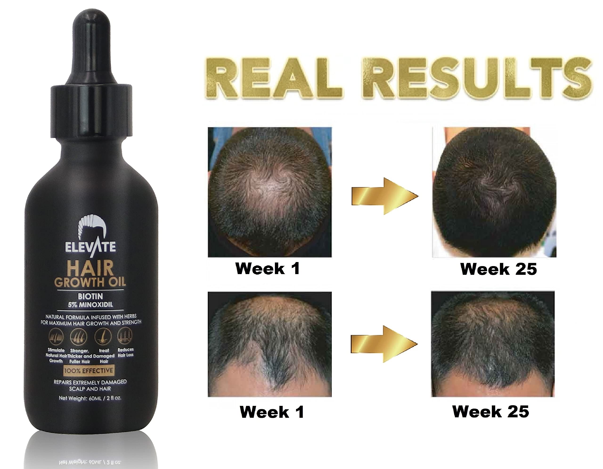 Elevate Hair Regrowth Treatment 5% Minoxidil with Biotin — Fuller, Thicker Hair (2oz)