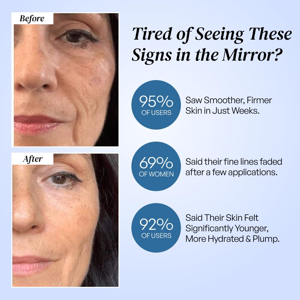 Eliré Korean Anti-Aging Cream with Vitamin C & Aloe – Firming Hydration for Sensitive Skin