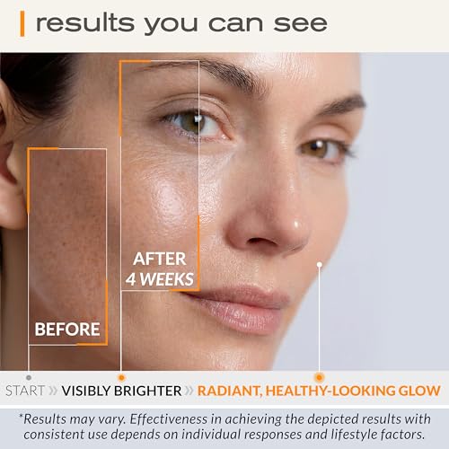 Ella & Eden Vitamin C Serum for Face – Hydrating, Brightening, Fragrance-Free (1 Fl Oz)