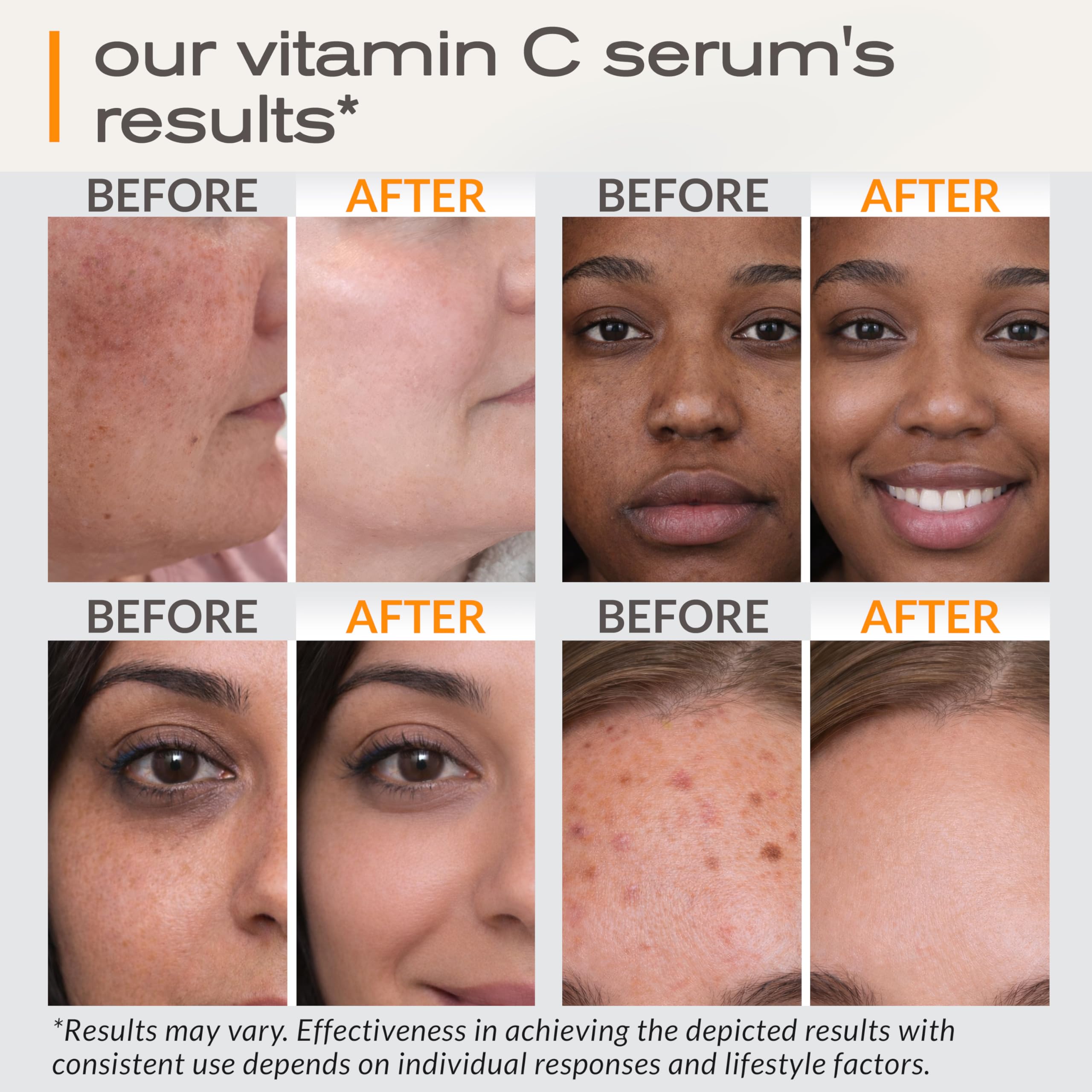 Ella & Eden Vitamin C Serum for Face – Hydrating, Brightening, Fragrance-Free (1 Fl Oz)