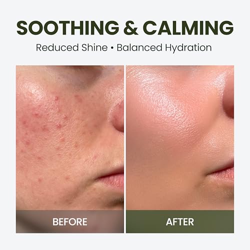elravie HyCicaMue Defence Cream | Barrier Repair Moisturizer with Cica & Hyaluronic Acid | Korean Skincare