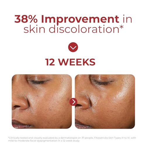 EltaMD UV Clear Tinted Face Sunscreen SPF 46 | Oil-Free with Zinc Oxide & Niacinamide | Dermatologist Recommended