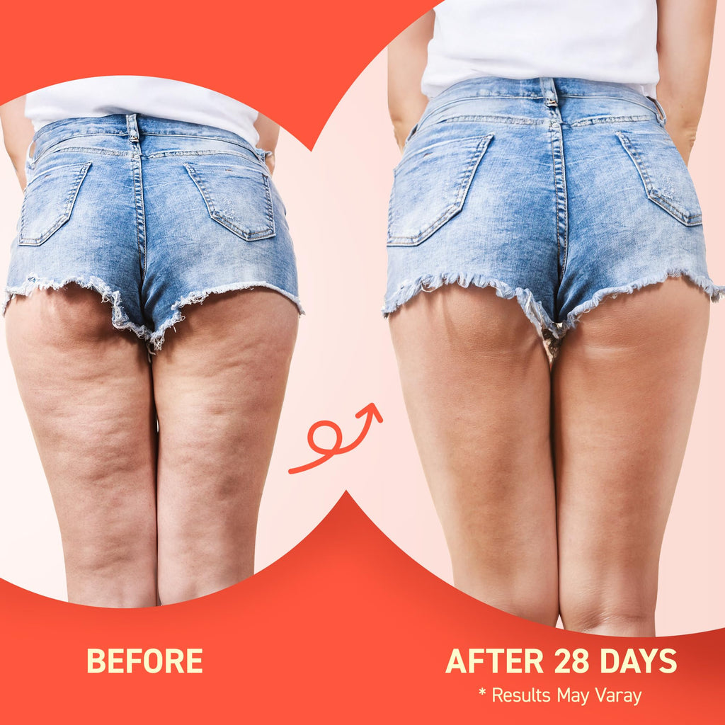 Enaskin Naturals Anti-Cellulite Cream: 3D Thermal Tightening & 72-Hour Moisture