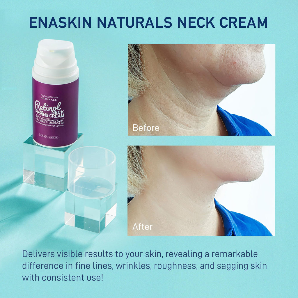 Enaskin Naturals Retinol Neck Firming Cream – Advanced Face Tightening with Hyaluronic Acid, Collagen & Vitamins (2.7 oz)
