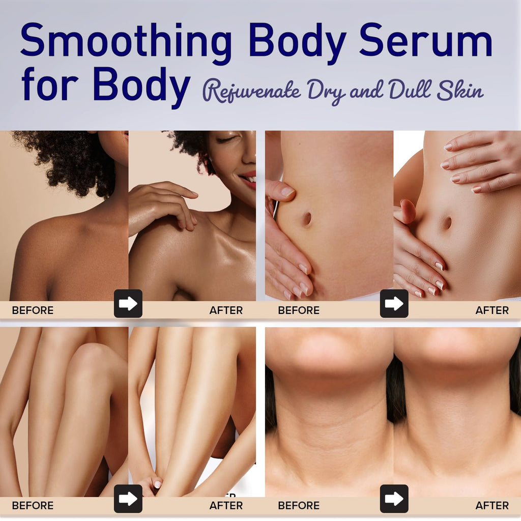 Enaskin Naturals Smoothing Body Serum Lotion – Hydrating Anti-Wrinkle Firming with Hyaluronic Acid & Niacinamide