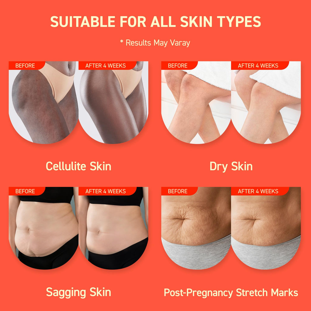 Enaskin Naturals Anti-Cellulite Cream: 3D Thermal Tightening & 72-Hour Moisture