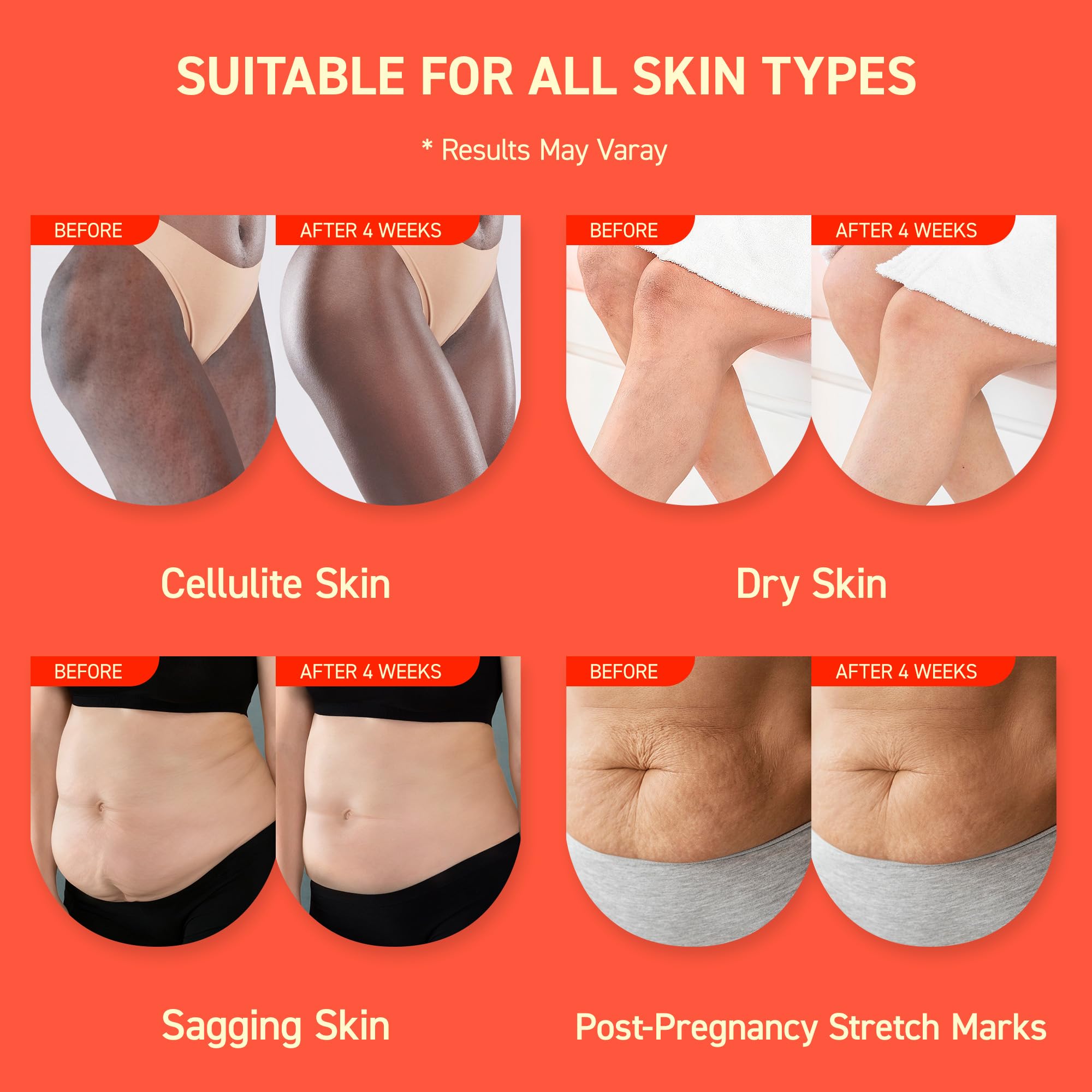 Enaskin Naturals Anti-Cellulite Cream: 3D Thermal Tightening & 72-Hour Moisture