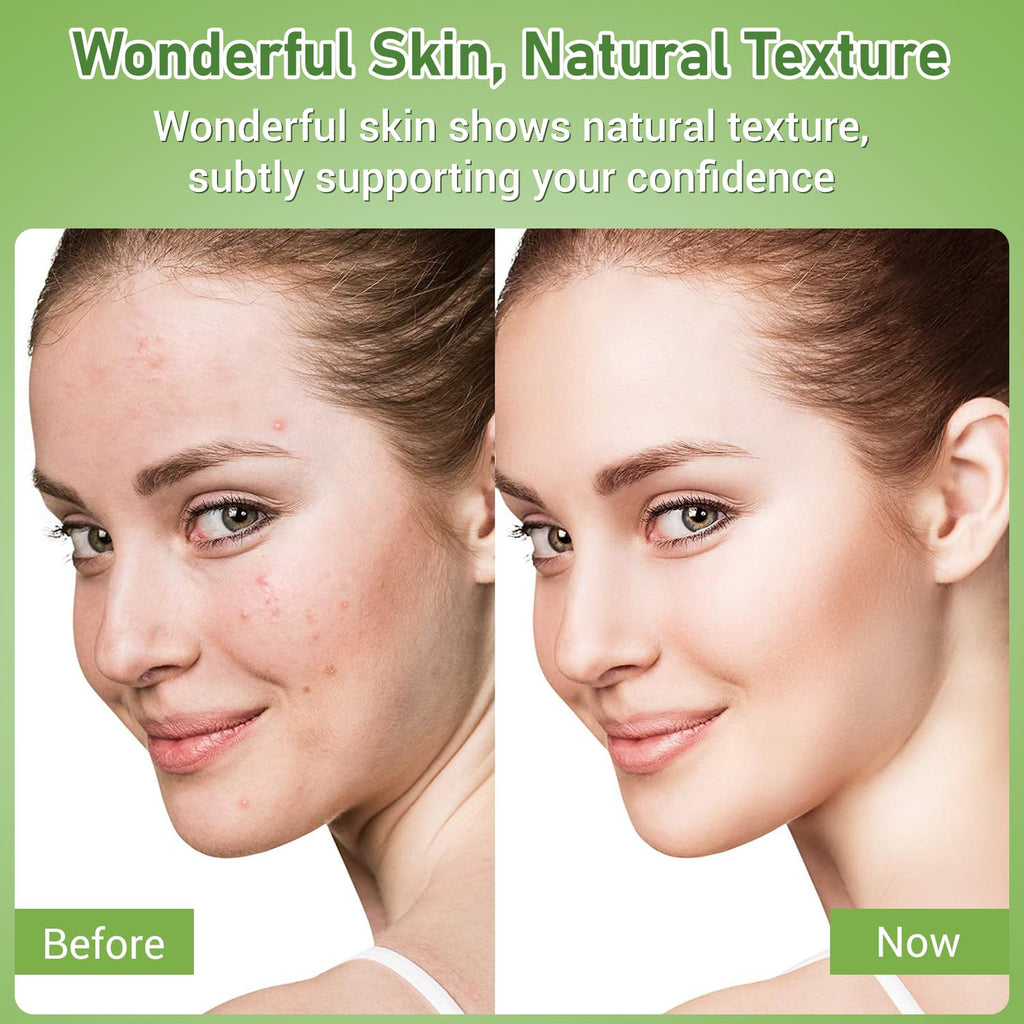 Eofot 14% Azelaic Acid Cream – Clearer-Looking Pores, Even Tone, Gentle Formula | 1 Fl Oz