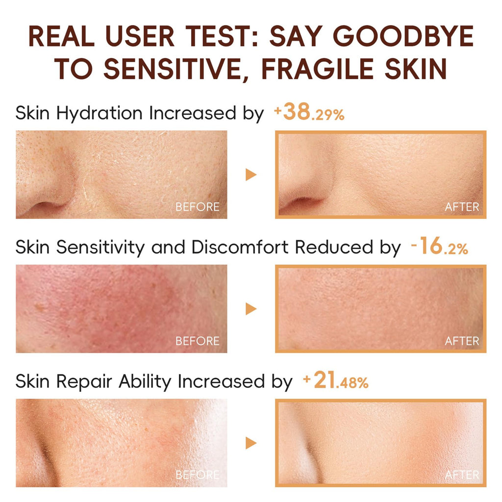 EONFAVE Rice Skincare Set for Teens — Hydrating Routine Kit (Cleanser, Serum, Sunscreen)
