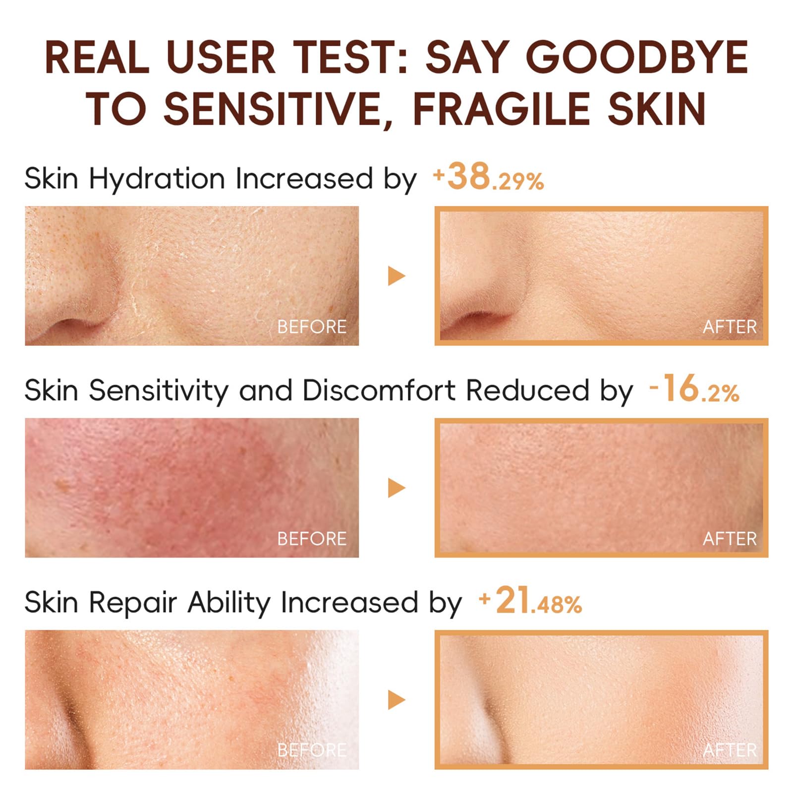 EONFAVE Rice Skincare Set for Teens — Hydrating Routine Kit (Cleanser, Serum, Sunscreen)