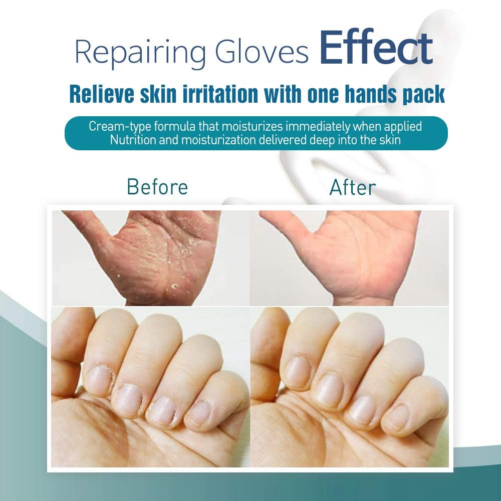 Epielle Intensive Repairing Hand Mask – 6 Pairs, Deep Moisturizing Gloves with Coconut Oil & Milk Extract