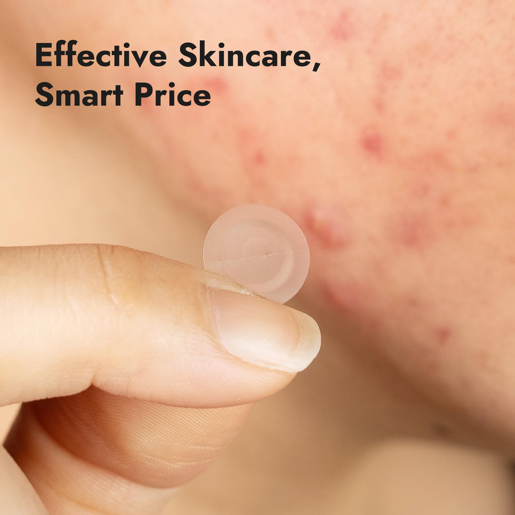 Epielle Over-Zit Acne Clear Patches – 138 Count Hydrocolloid Acne Pimple Patches