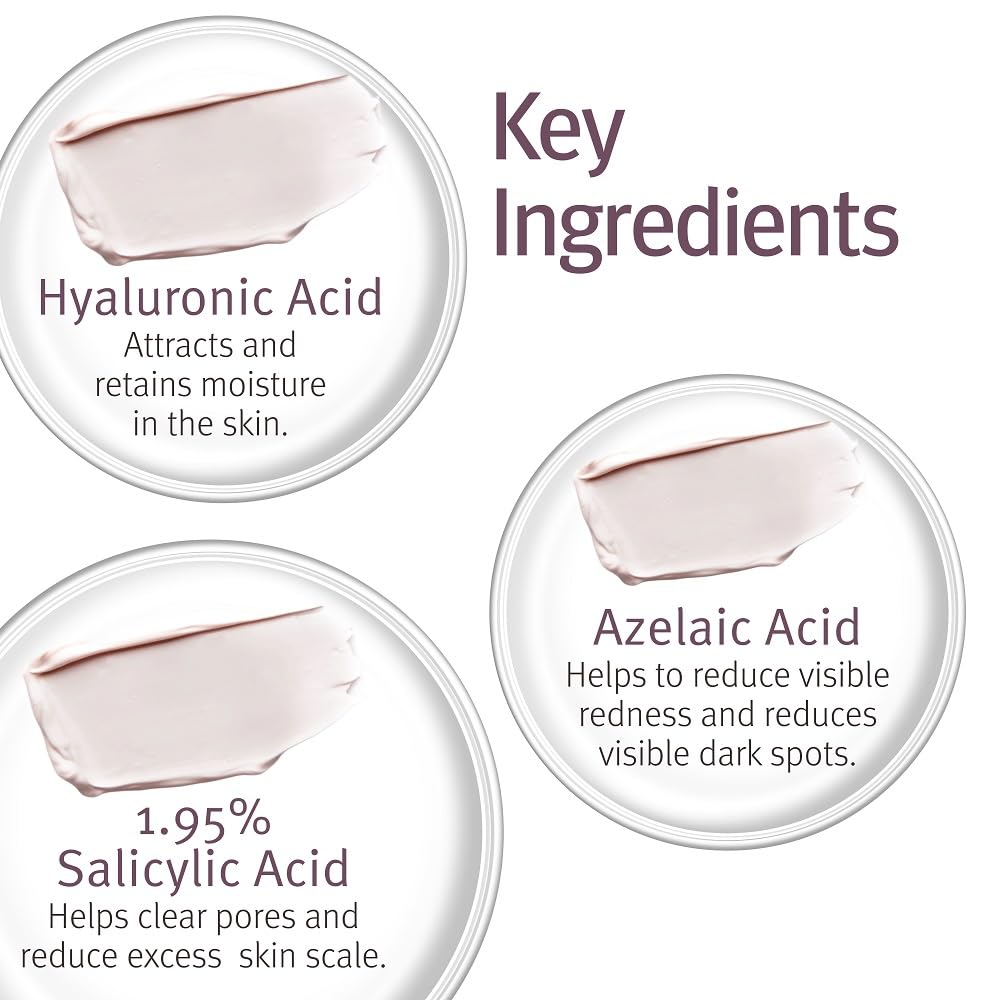 Epionce Lytic Tx – Moderate-Strength Pore-Cleansing Treatment for Combination to Oily Skin
