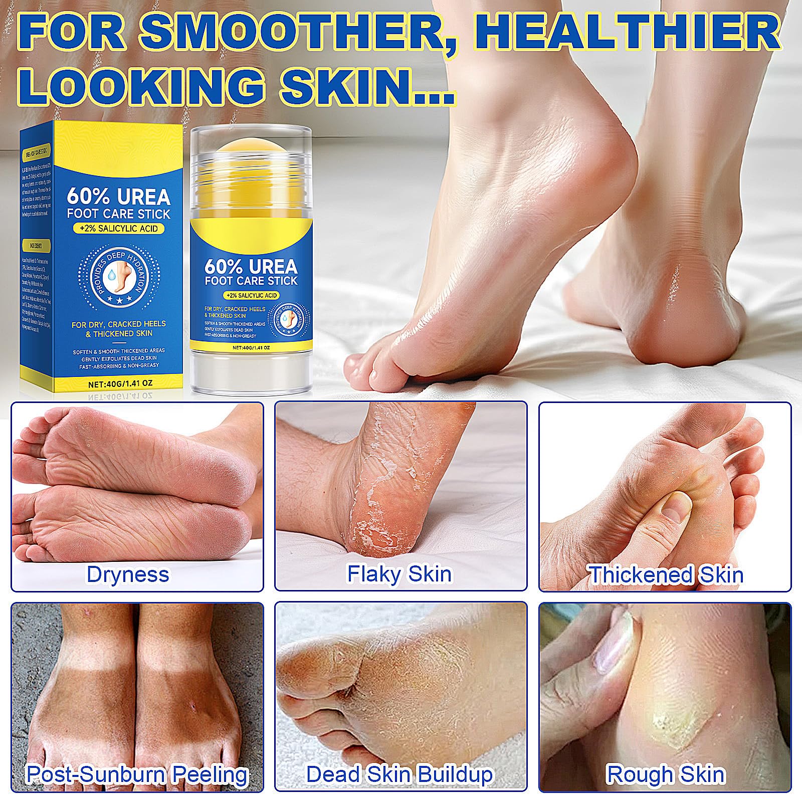 Eqimznv 60% Urea Cream Stick with 2% Salicylic Acid – Maximum Strength Foot Moisturizer (2PCS)