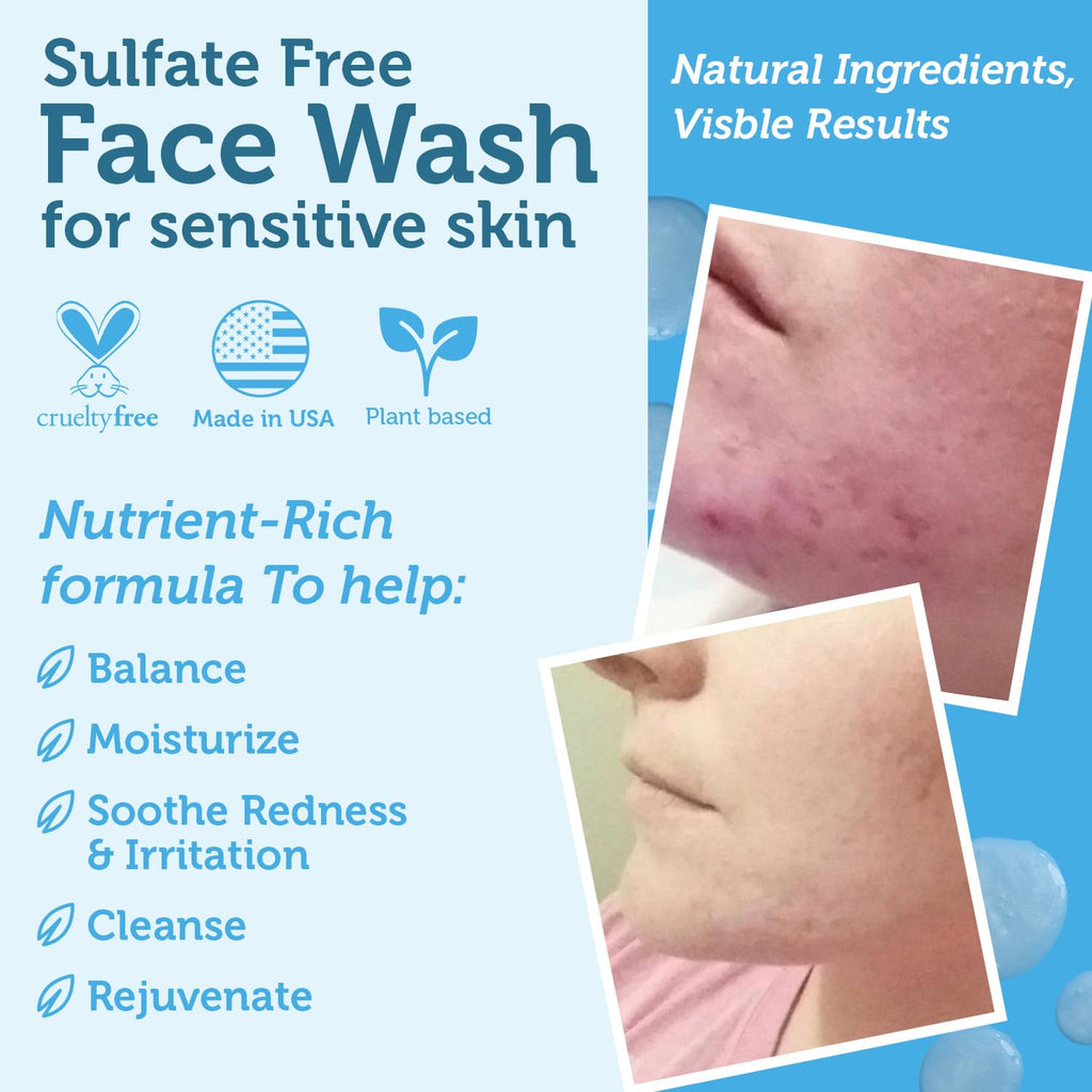 Era Organics Manuka Honey Face Wash for Sensitive Skin – Sulfate-Free Cleanser with Aloe Vera & Hyaluronic Acid (USA) - 8 oz