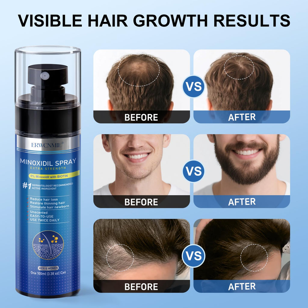 ERWCNMIE 5% Minoxidil Spray for Men & Women – 7 Bottle Pack (11‑Month Supply)