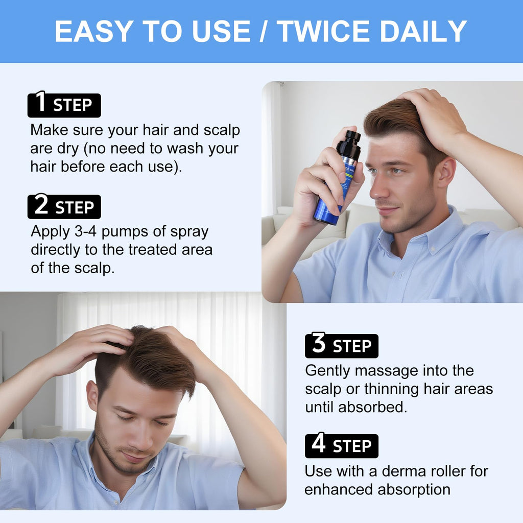 ERWCNMIE 5% Minoxidil Spray for Men & Women – 7 Bottle Pack (11‑Month Supply)