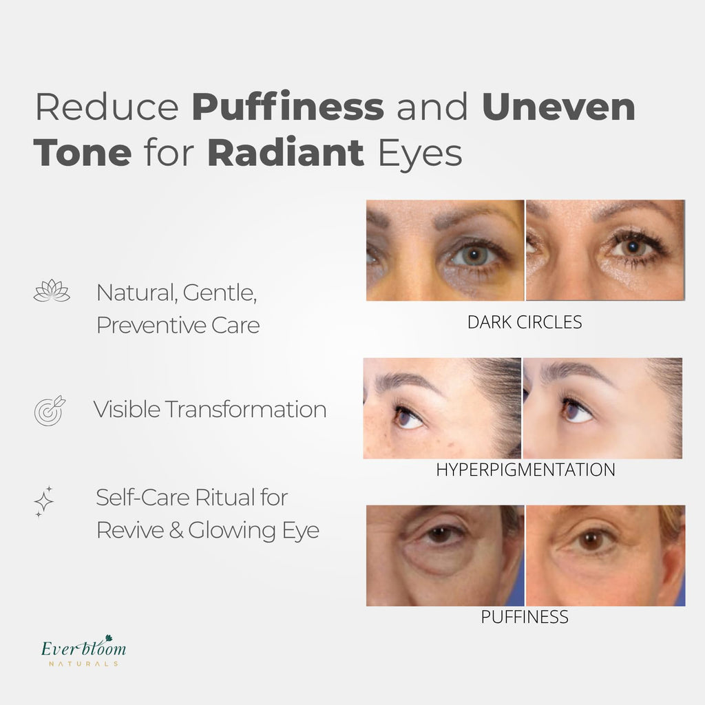 Everbloom Naturals Tranexamic Eye Serum Roller — Bakuchiol, Argireline & Caffeine for Dark Circles