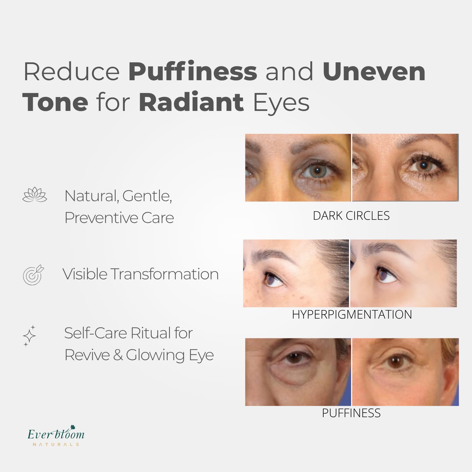 Everbloom Naturals Tranexamic Eye Serum Roller — Bakuchiol, Argireline & Caffeine for Dark Circles