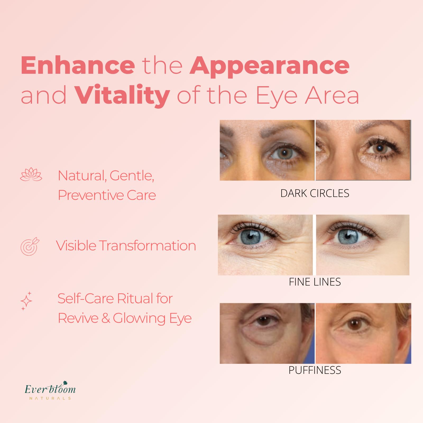 Everbloom Naturals Salmon DNA PDRN Eye Serum Roller with Bakuchiol, Argireline, and Caffeine