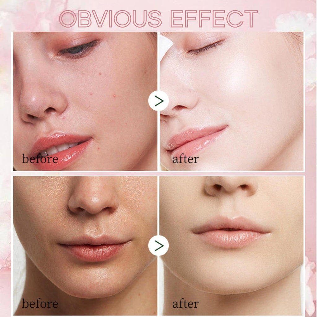 Evolvique Japan Sakura Skincare Set for Teens – 8-Piece Gift Kit