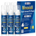 Exdeploy 5% Minoxidil Foam for Men – 5-Pack with Biotin (10.5 oz total)
