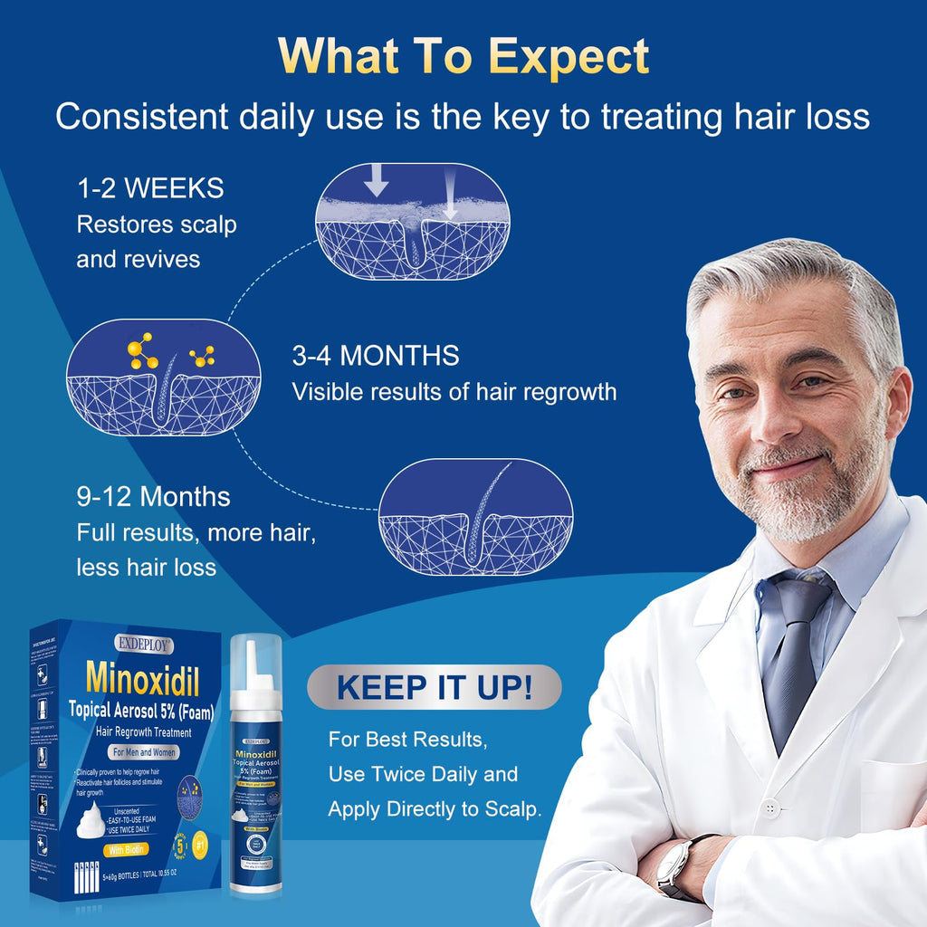 Exdeploy 5% Minoxidil Foam for Men – 5-Pack with Biotin (10.5 oz total)