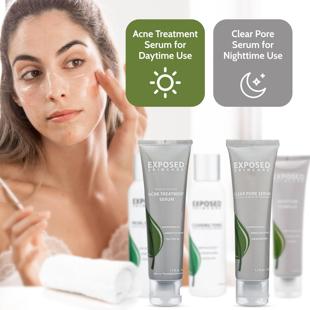 Exposed Skin Care Expanded Acne Treatment Kit – 2.5% Salicylic Acid & 3.5% Benzoyl Peroxide