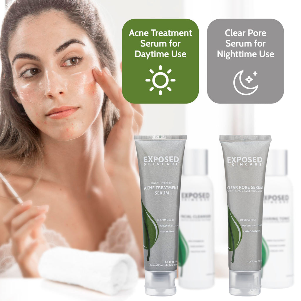 Exposed Skin Care Basic Acne Treatment Kit — 2.5% Salicylic Acid + 3.5% Benzoyl Peroxide
