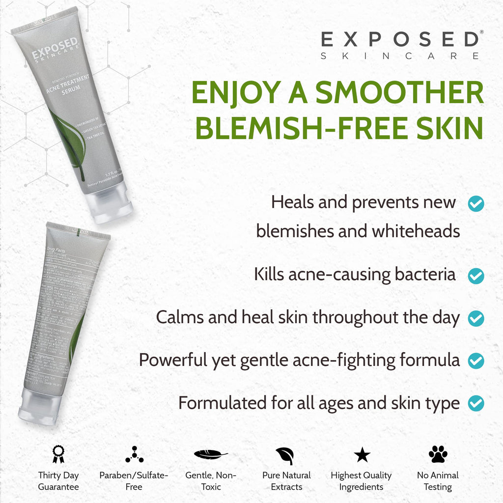 Exposed Skin Care Acne Treatment Serum with 3.5% Benzoyl Peroxide – Lightweight Spot Treatment for Teens, Adults, Hormonal & Cystic Acne – Cruelty Free