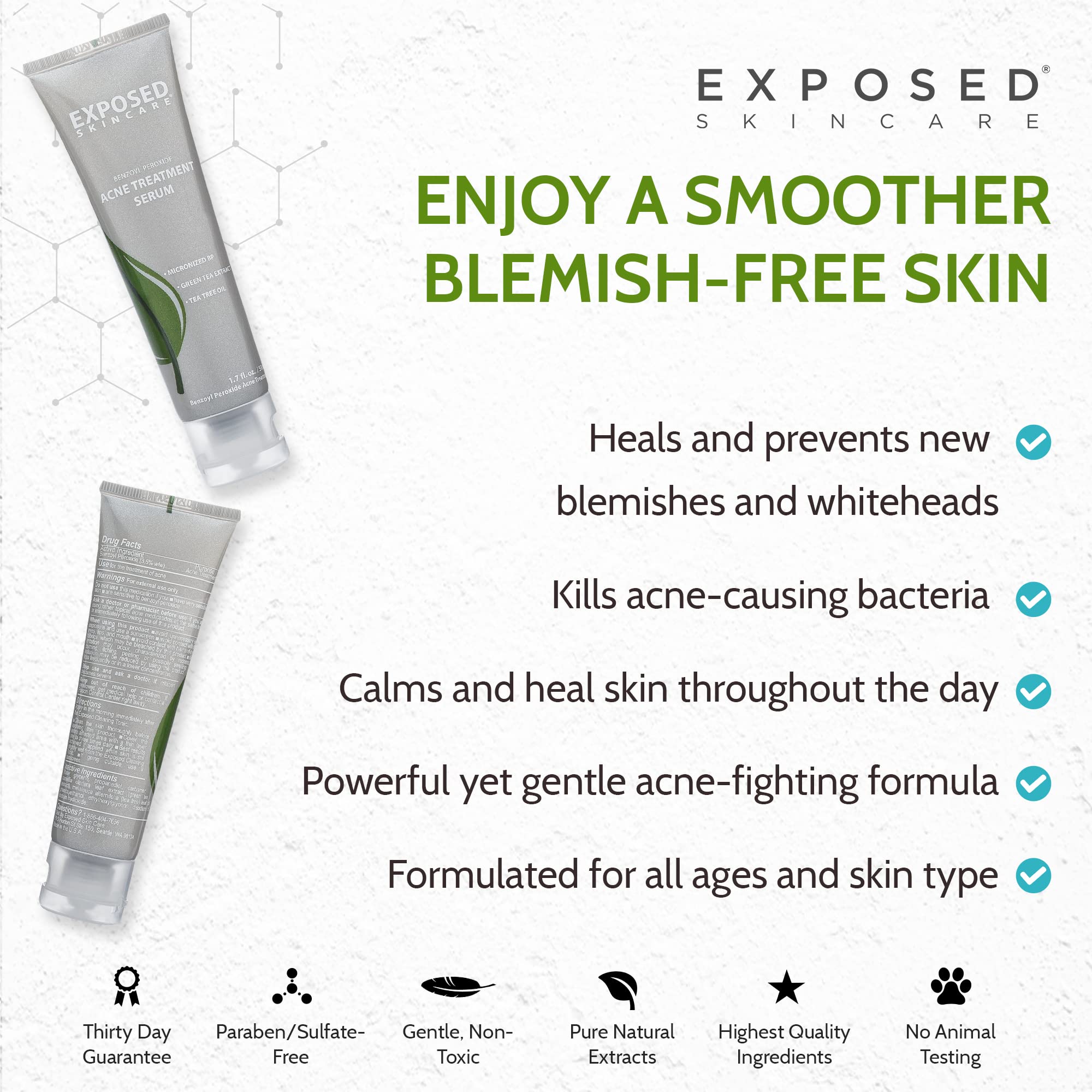 Exposed Skin Care Acne Treatment Serum with 3.5% Benzoyl Peroxide – Lightweight Spot Treatment for Teens, Adults, Hormonal & Cystic Acne – Cruelty Free