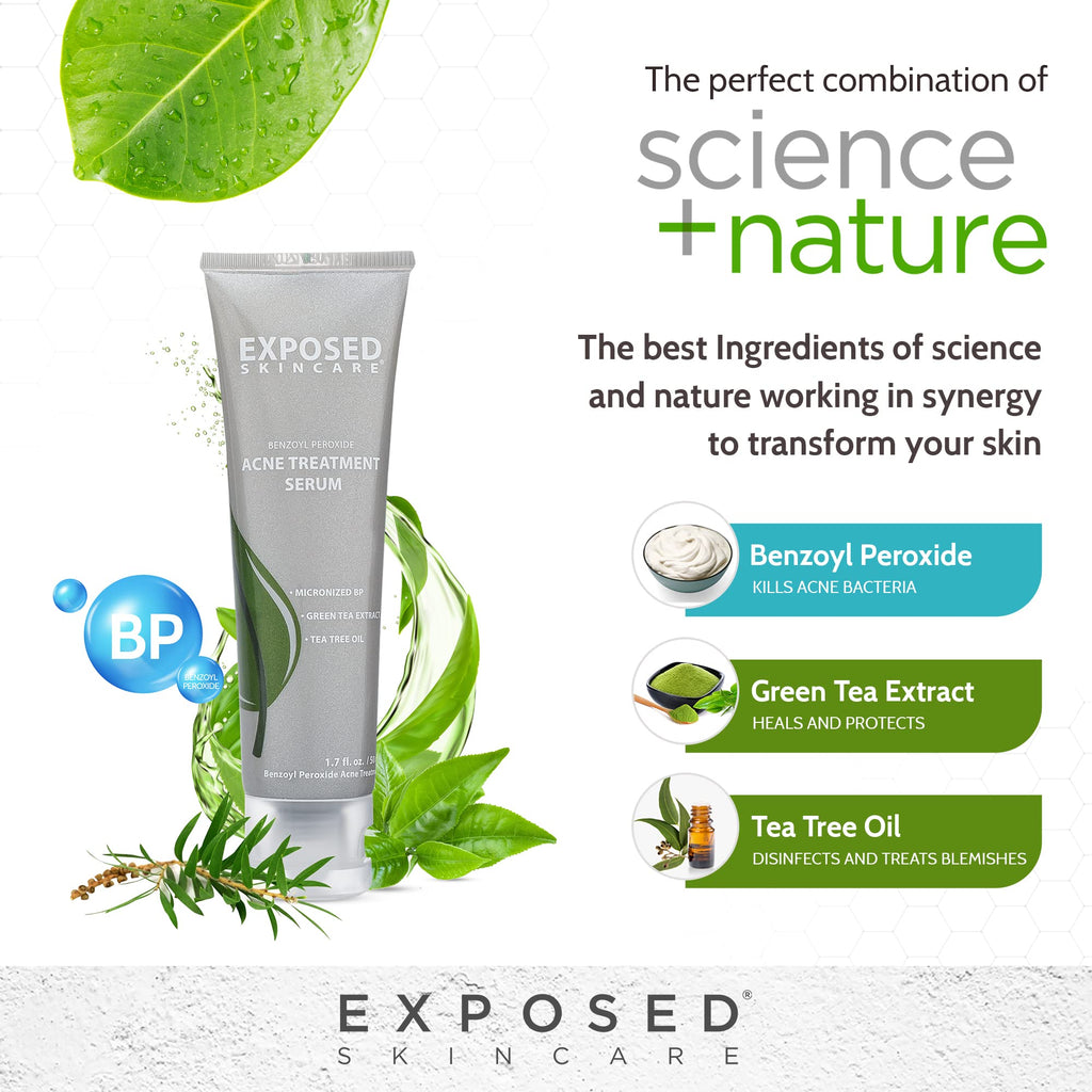 Exposed Skin Care Acne Treatment Serum with 3.5% Benzoyl Peroxide – Lightweight Spot Treatment for Teens, Adults, Hormonal & Cystic Acne – Cruelty Free