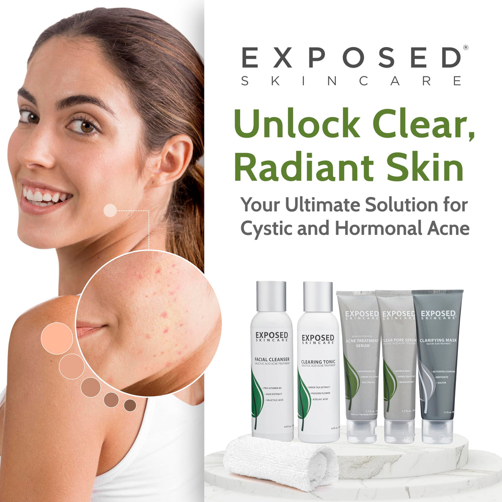 Exposed Skin Care Acne Treatment Kit — 2.5% Salicylic Acid + 3.5% Benzoyl Peroxide, Natural & Cruelty-Free