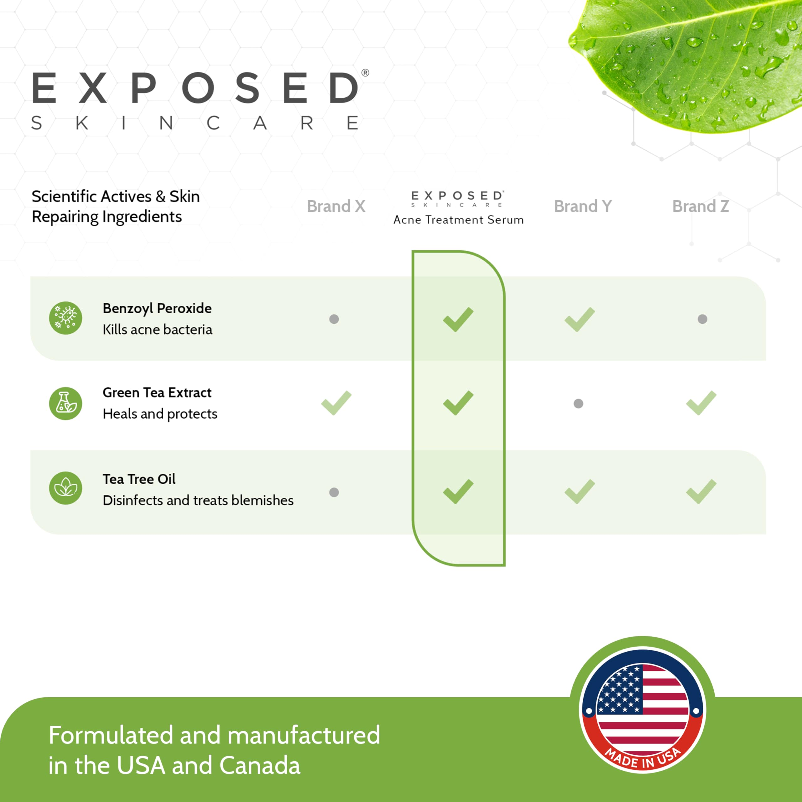 Exposed Skin Care Acne Treatment Serum with 3.5% Benzoyl Peroxide – Lightweight Spot Treatment for Teens, Adults, Hormonal & Cystic Acne – Cruelty Free