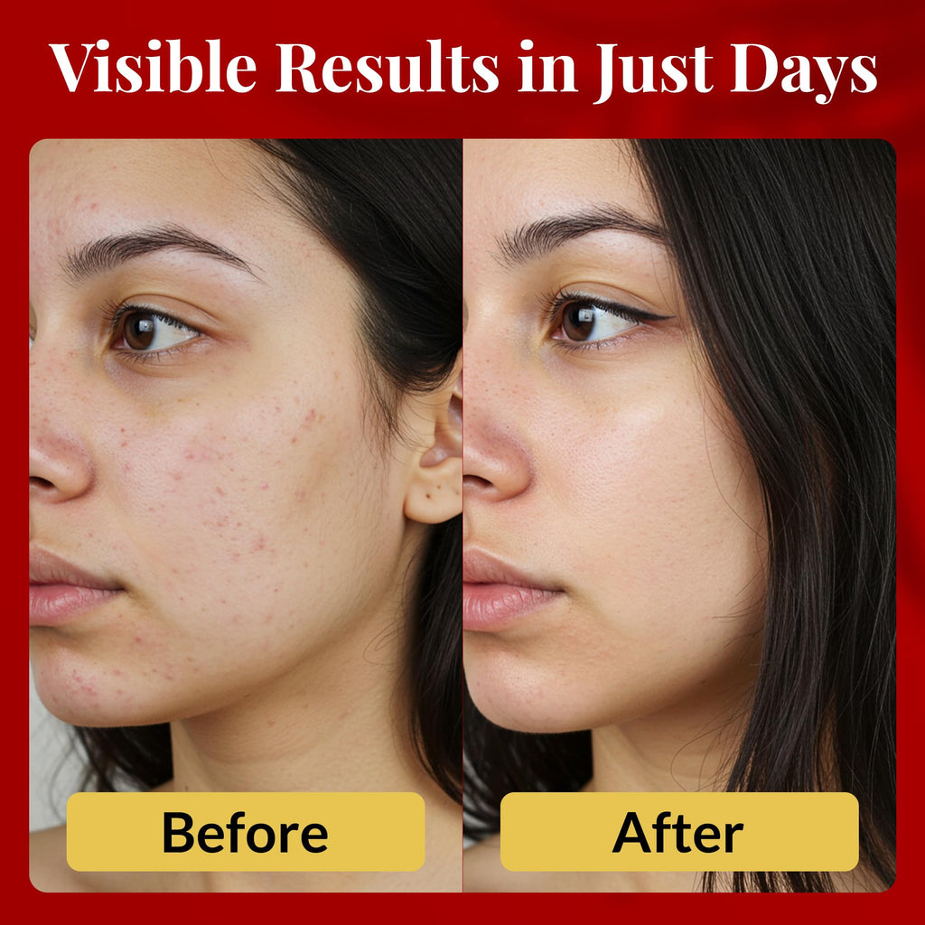 FACEDOCTOR Complexion Bar Soap | Gentle Acne & Rosacea Cleanser with Sea Buckthorn
