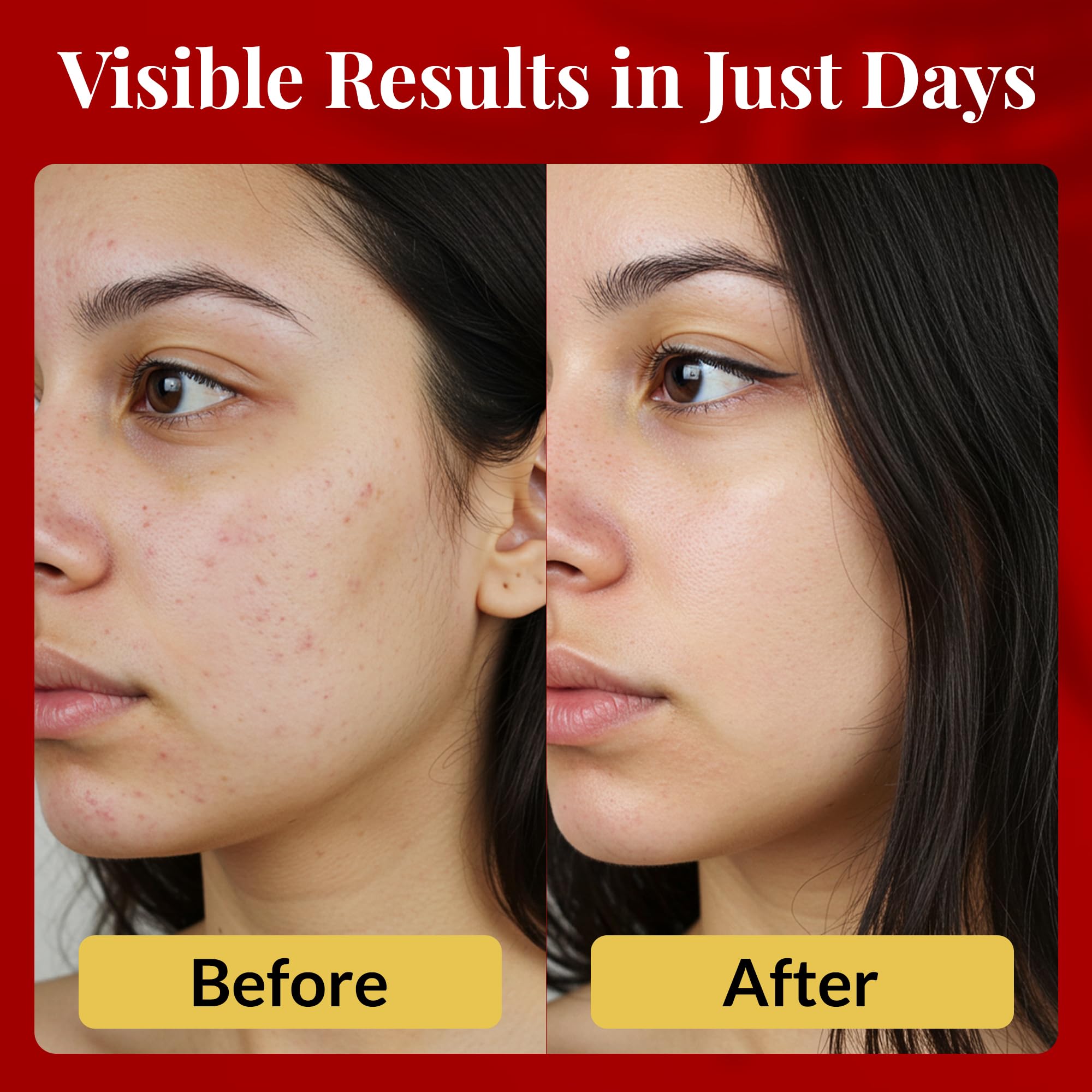 FACEDOCTOR Complexion Bar Soap | Gentle Acne & Rosacea Cleanser with Sea Buckthorn