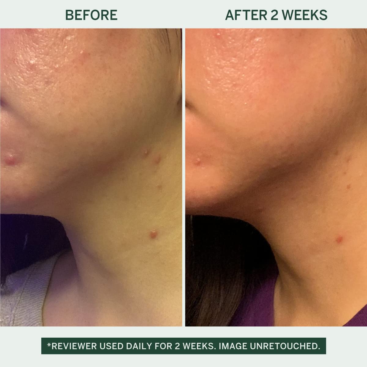 FACETORY Urban Calm Barrier Cream — Hydrating Face Moisturizer with Hyaluronic Acid & Fermented Honeybush