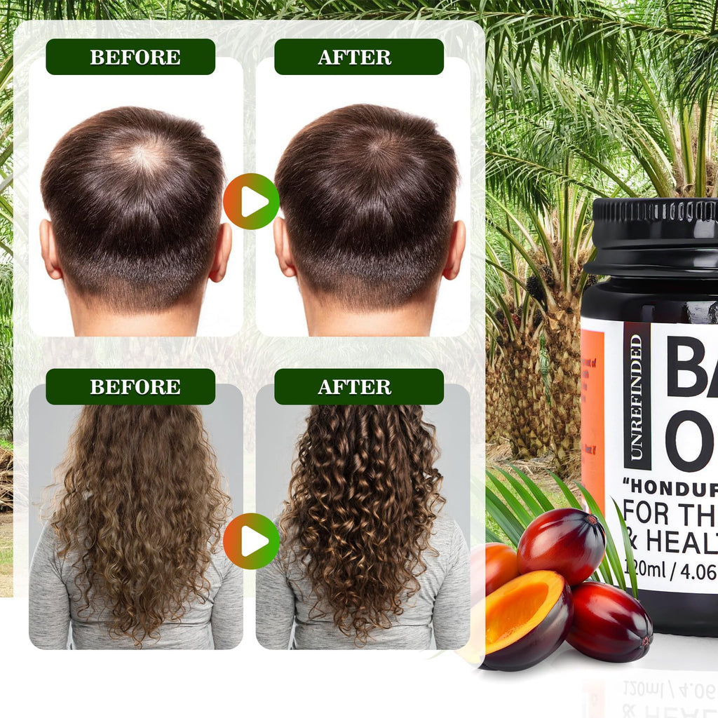 Fadelo Organic Batana Oil for Hair Growth – 100% Pure Batana from Honduras, 4 fl oz