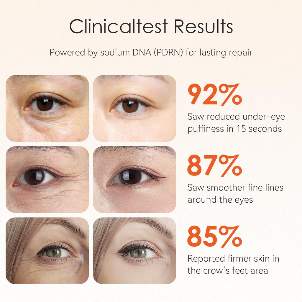 Fankr 15-Second Eye Lift Cream | Sodium DNA, 0.1% Retinal, Caffeine & Peptides