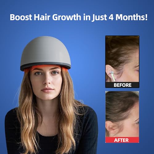 faq101 Hair Growth Device with Laser Red Light Therapy – FDA Cleared