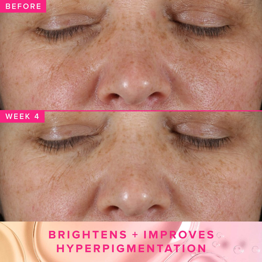 Farmacy 3% TXA Brightening Toner - Dark Spot Corrector with Azelaic Acid + 5% PHA (50ml)
