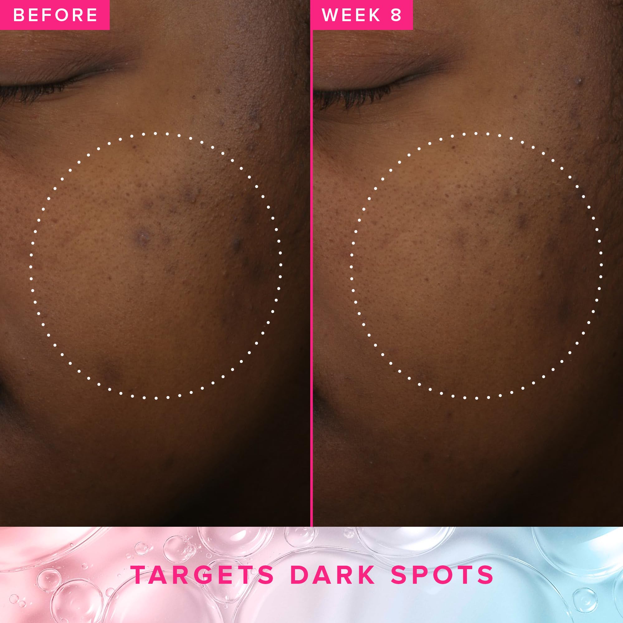 Farmacy 3% TXA Brightening Toner - Dark Spot Corrector with Azelaic Acid + 5% PHA (50ml)