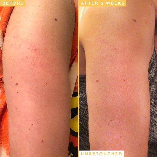 Farmacy Honeymoon Glow Body - AHA/BHA Serum with Hyaluronic Acid