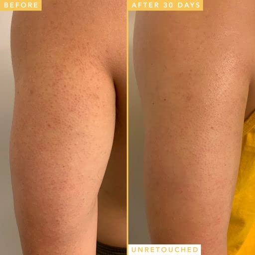 Farmacy Honeymoon Glow Body - AHA/BHA Serum with Hyaluronic Acid